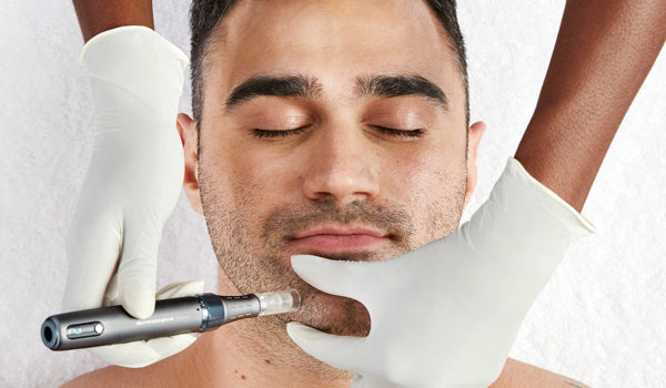 Microneedling